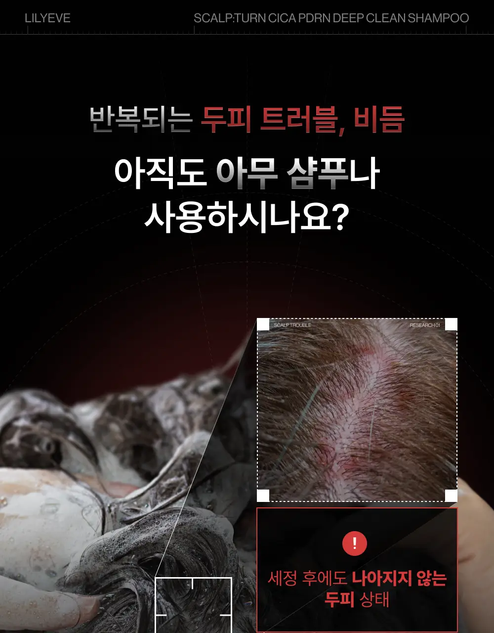 [포켓몬 에디션][비듬/각질케어]릴리이브 스칼프턴 시카 PDRN 딥클린 샴푸 500g 2종 택1 상세페이지 13